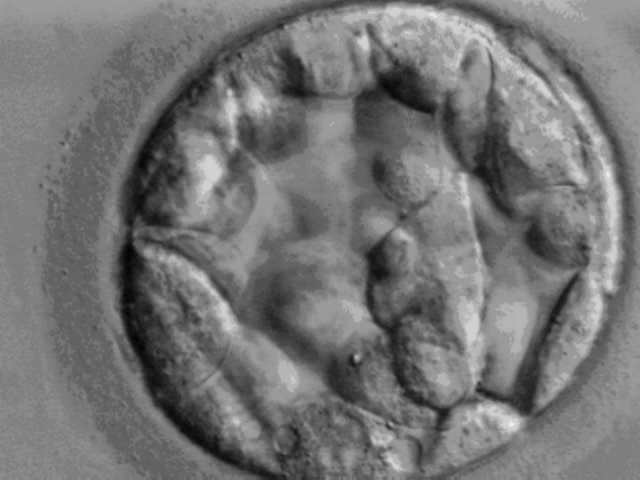 Blastocyst. Source: Wikimedia Commons.