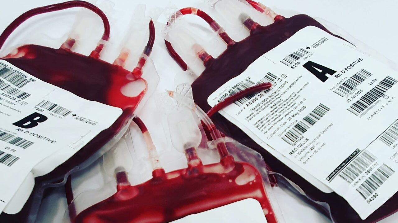 https://www.pexels.com/photo/a-close-up-shot-of-bags-of-blood-4531306/